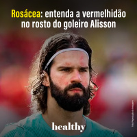 T17E19 - Rosácea: entenda a vermelhidão no rosto do goleiro Alisson