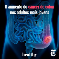 T9E15: O aumento do câncer de cólon nos adultos mais jovens