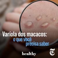 T7E15: Varíola dos macacos