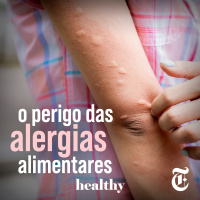 T5E11: O perigo das alergias alimentares