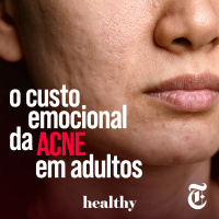 T6E7: O custo emocional da acne em adultos
